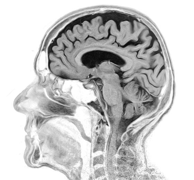 Brain MRI Image